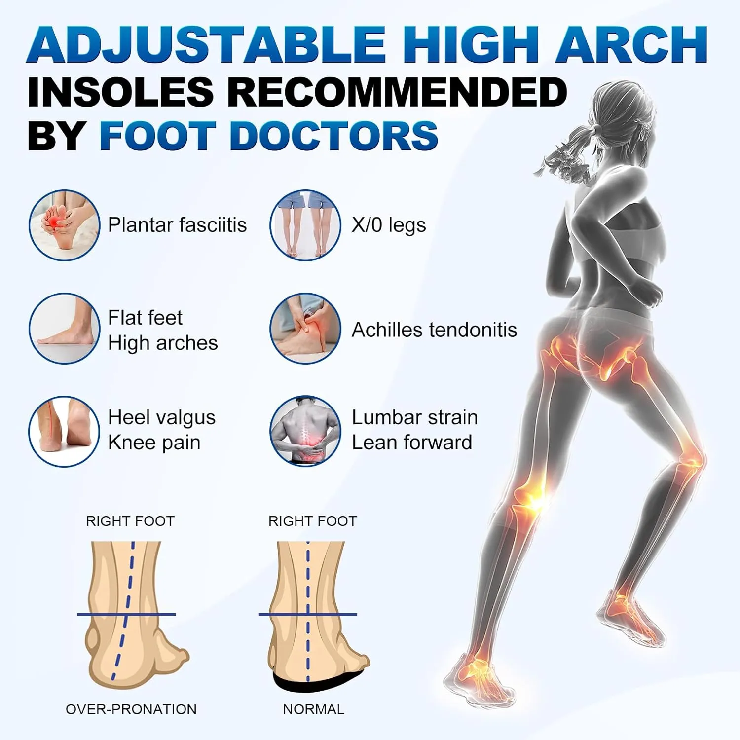 3/4 Removable High Arch Support Shoe Inserts, Orthopedic Insoles for Plantar Fasciitis Relief, Standing All Day Pain Relief, Knee Pain, Over-Pronation, Shoe Insoles for Men & Women - S(Men's 4.5-6)