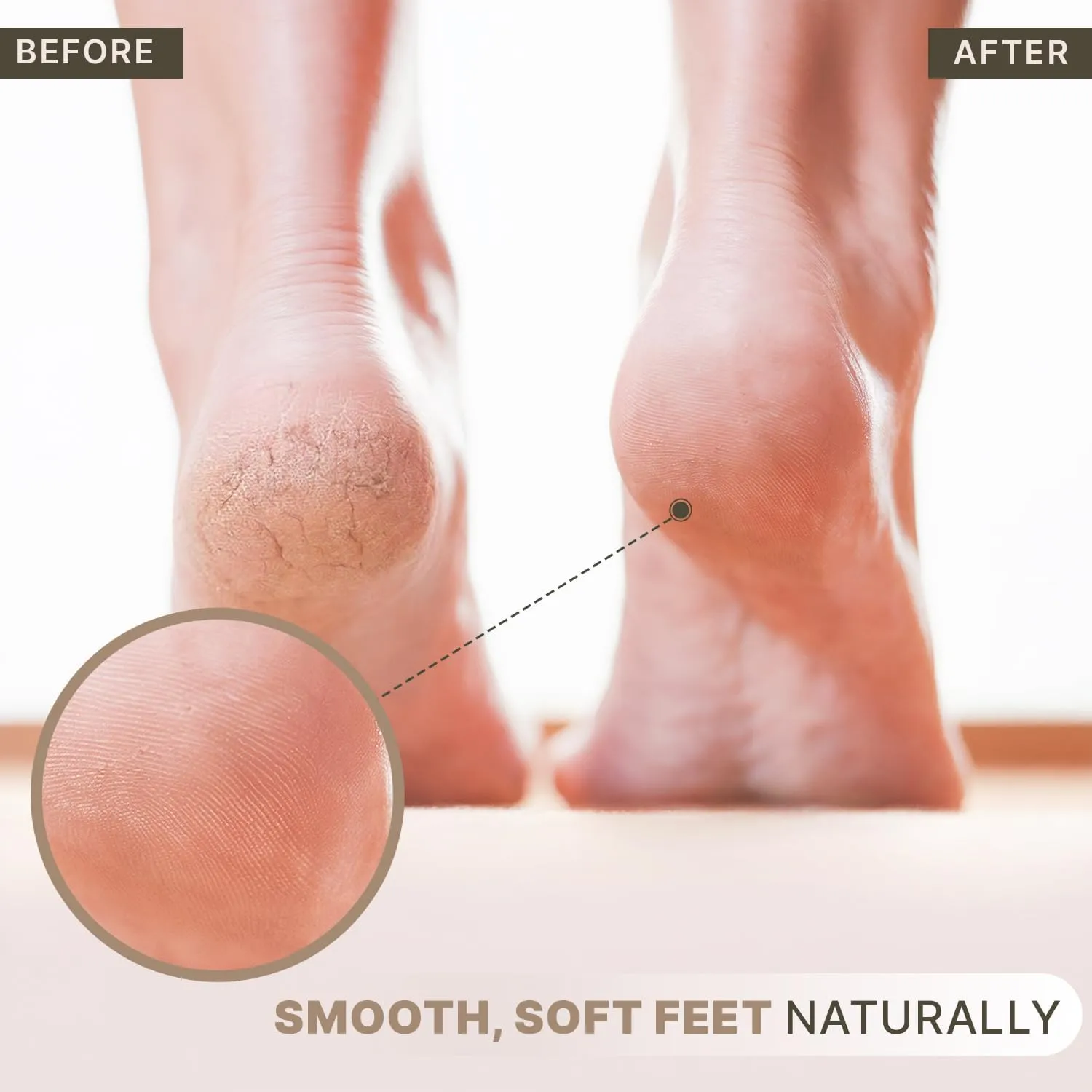 Beauty by Earth Pumice Stone for Feet - Natural Lava Stone Foot Exfoliator, Callus Remover, Foot Scrubber, Cracked Heels Solution, Strong & Durable Design for Smooth & Soft Feet