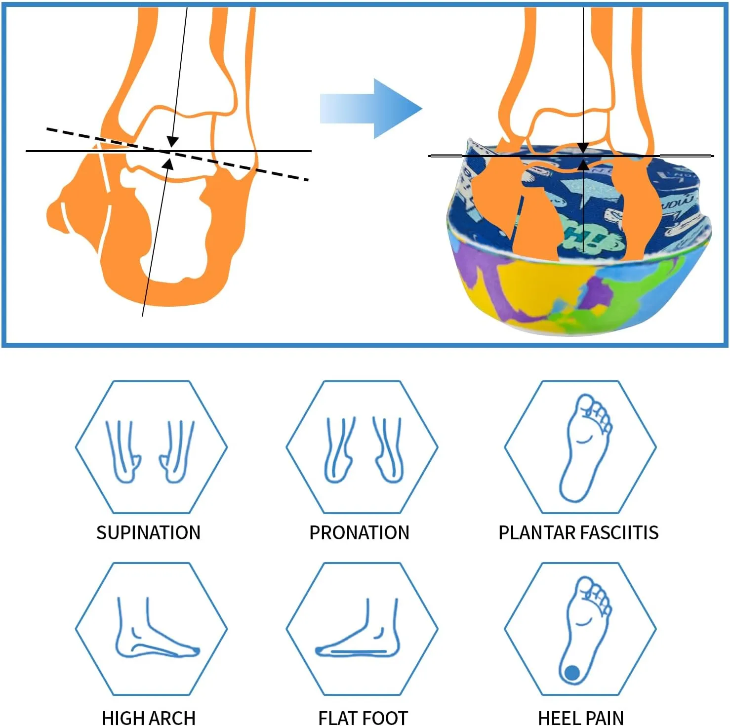 Kids Arch Support Orthotics Plantar Fasciitis Flat Feet Over-Pronation Insoles Relieve Arch, Heel & Ankle Foot Pain Inserts with Heel Cushion (6.5M Big Kid, Multicolor)