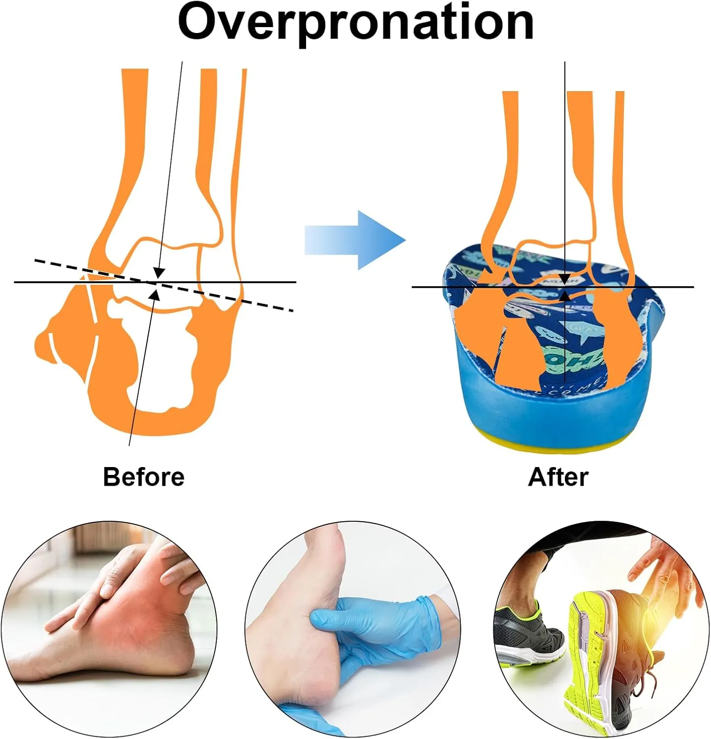Kids Insoles for Over-Pronation Soft PU Foam Orthotics Relieve Plantar Fasciitis Flat Foot Child Inserts Gel Heel Cushion (Multicolor, 3-7M Toddler)