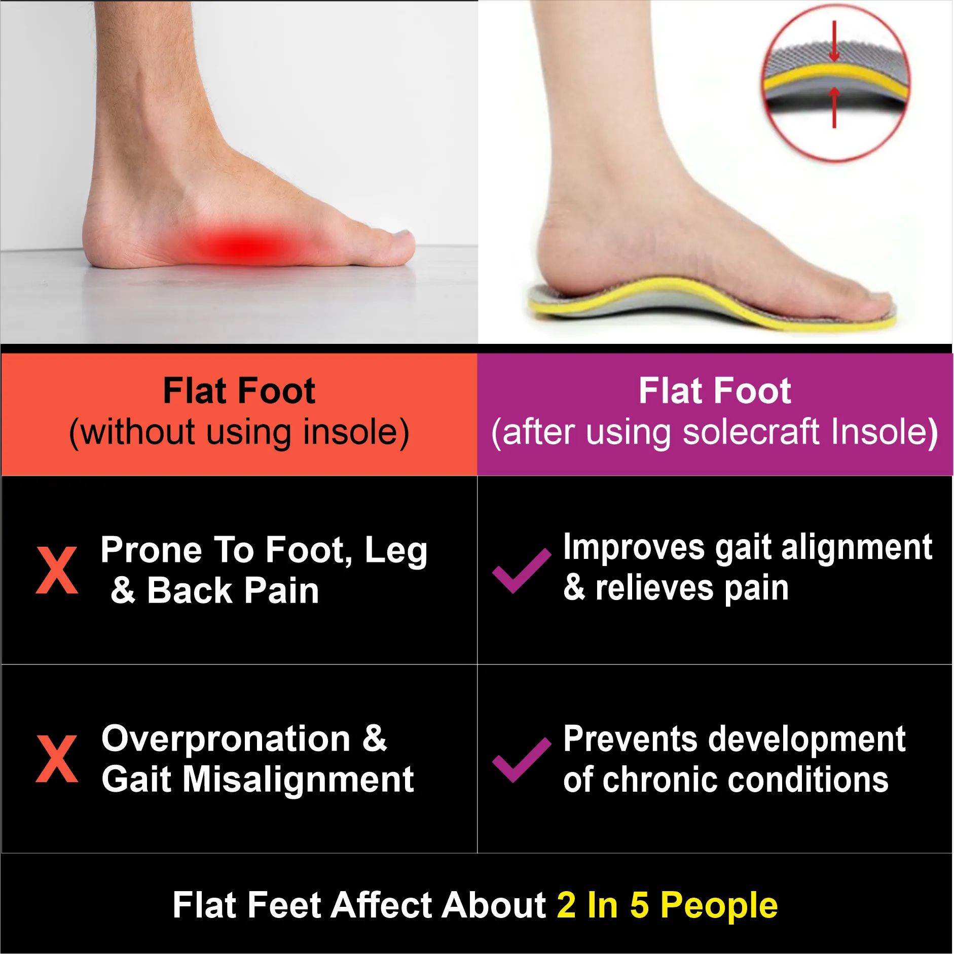 Solecraft Arch Support   Insole (Rigid support)