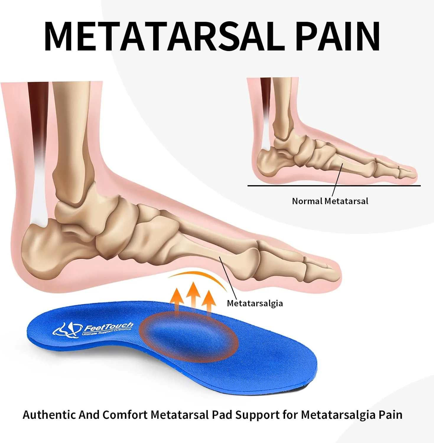 Strong High Arch Support Metatarsal Pad Orthotics for Morton's Neuroma,Ball of Foot Pain, Metatarsalgia Plantar Fasciitis Inserts with Poron Heel Cushion